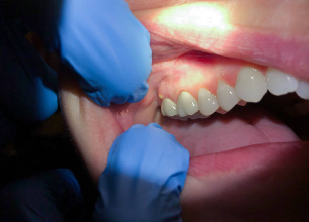 Best Orthodontic Emergency Dentist in Justice, IL