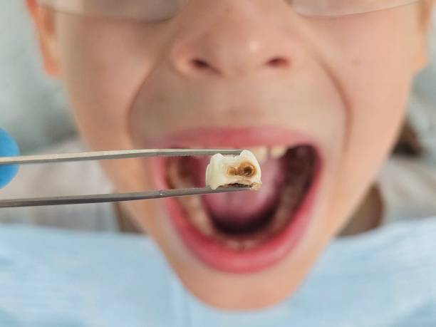 Best Emergency Dental Care for Abscessed Tooth in Justice, IL