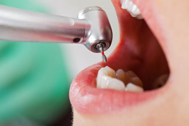 Best Emergency Dental Extractions in Justice, IL